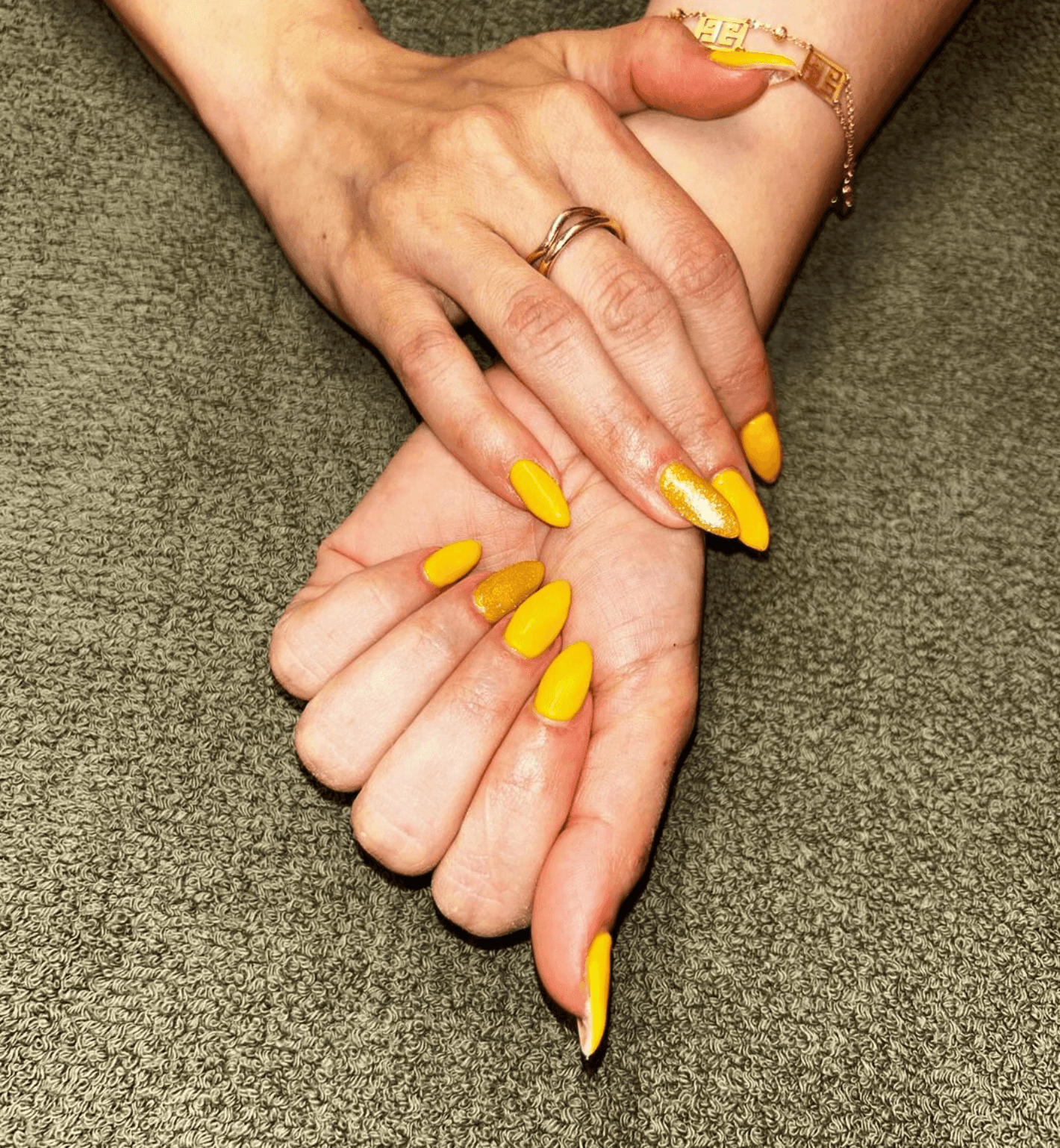 Two hands with bright yellow almond-shaped nails resting on a textured gray surface.